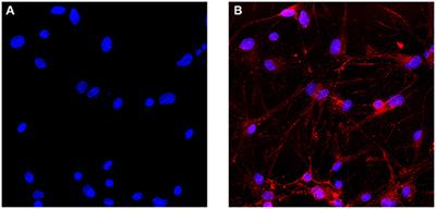 Ozone Exposure Induces Metabolic Disorders and NAD+ Depletion Through PARP1 Activation in Spinal Cord Neurons